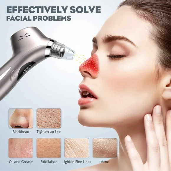 Blackhead Remover Pore Vacuum, USB Rechargeable Acne Cleaner - Picture 4 of 7